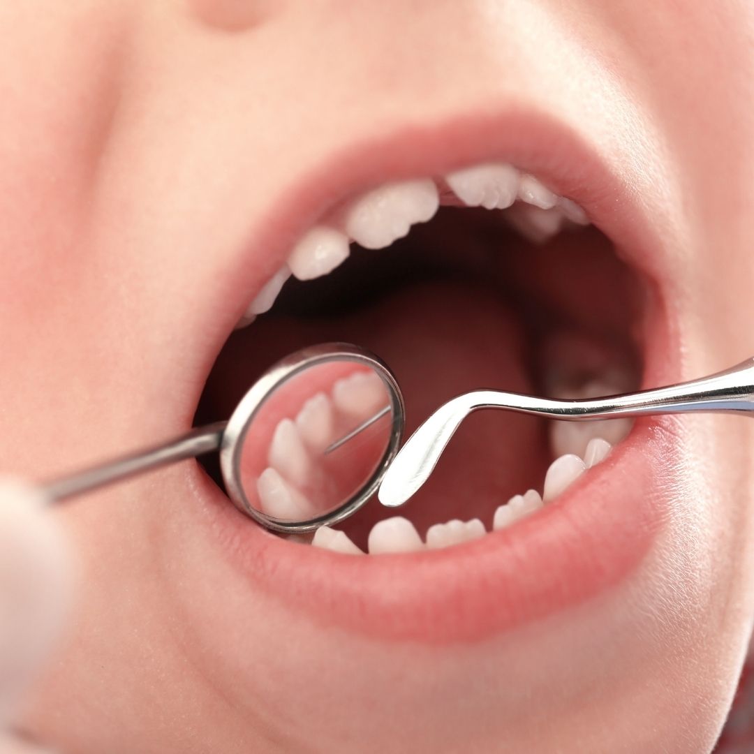 dentist inspecting child's teeth